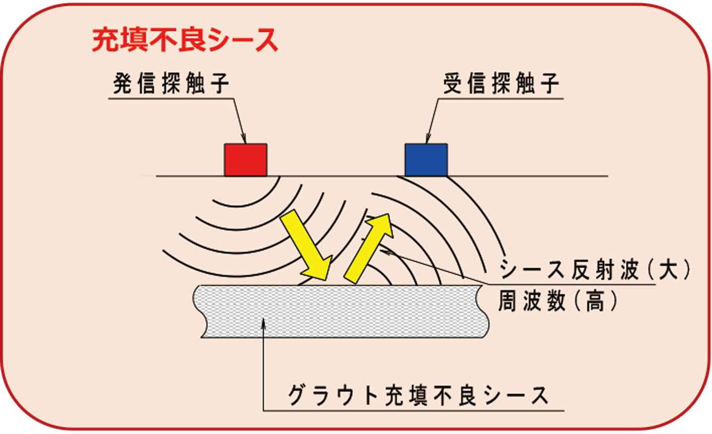 不良充填シース